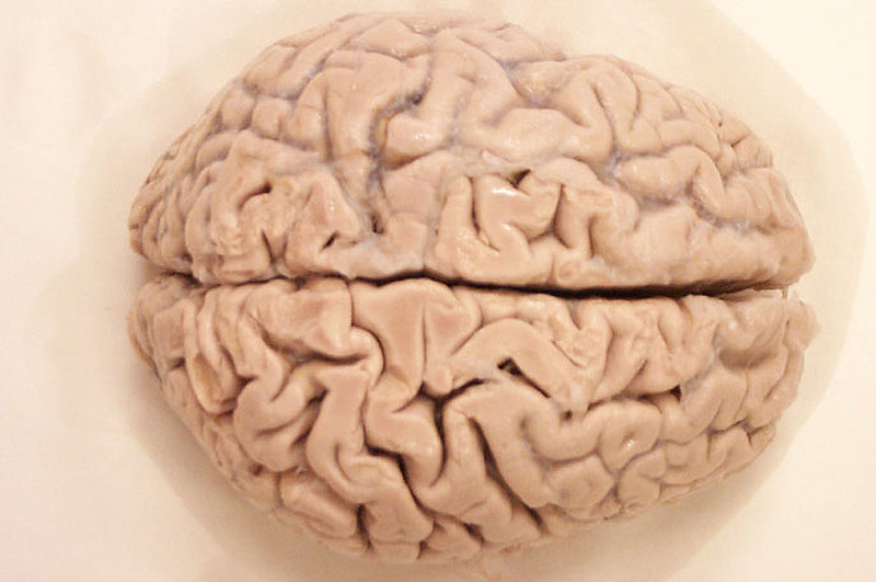 top-down view of formalin-fixed human brain top-down view of formalin-fixed human brain