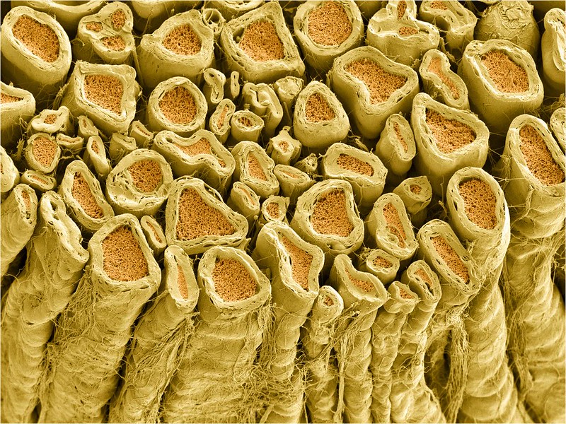 microscopy image of myelinated axons microscopy image of myelinated axons