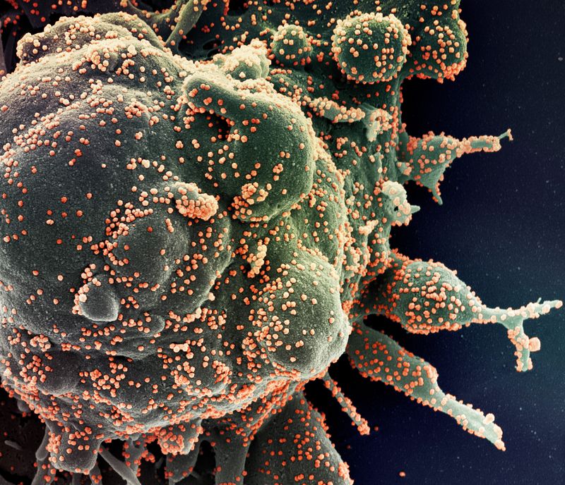 Colorized scanning electron micrograph of an apoptotic cell (green) heavily infected with SARS-COV-2 virus particles (orange), isolated from a patient sample.