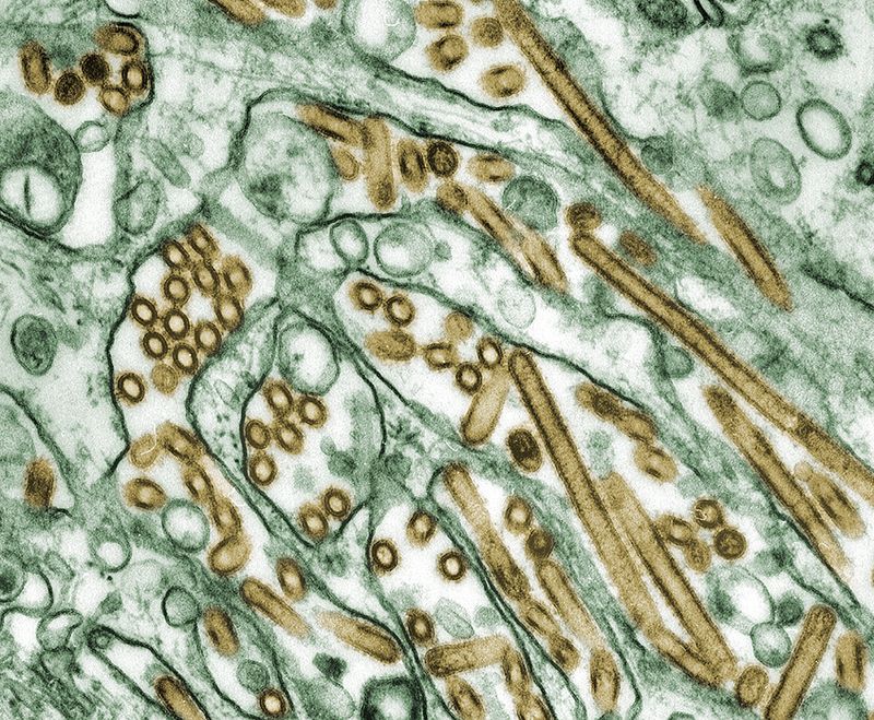 Transmission electron micrograph of gold rod and ball-shaped H5N1 influenza virus particles within green kidney cells