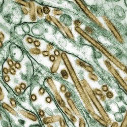 Transmission electron micrograph of gold rod and ball-shaped H5N1 influenza virus particles within green kidney cells