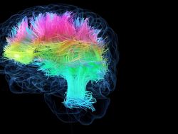 3d rendered medical illustration of colored white brain matter fibers.