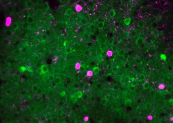 microscope image of green visual cortex neurons with a few VIP neurons in magenta microscope image of green visual cortex neurons with a few VIP neurons in magenta