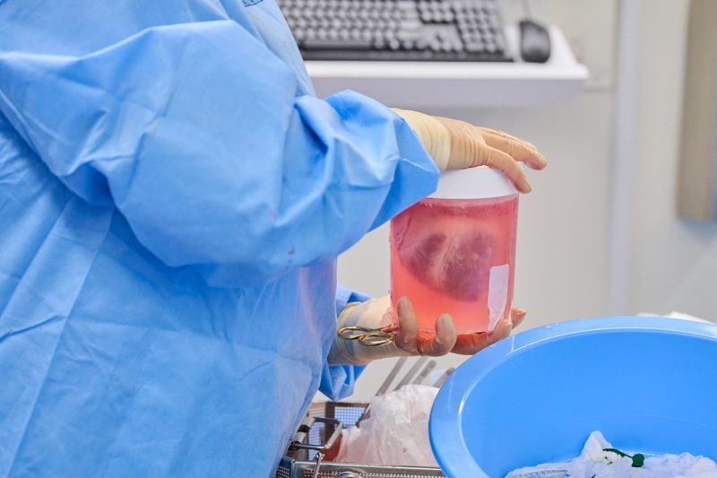 Pig heart xenotransplant. 