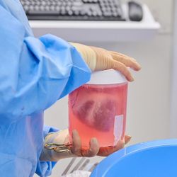 Pig heart xenotransplant. 