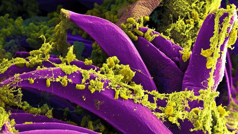 digitally colorized scanning electron microscopic (SEM) image depicts a number of yellow-colored, Yersinia pestis bacteria, that had gathered on the proventricular spines of a Xenopsylla cheopis flea.