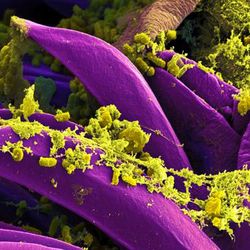 digitally colorized scanning electron microscopic (SEM) image depicts a number of yellow-colored, Yersinia pestis bacteria, that had gathered on the proventricular spines of a Xenopsylla cheopis flea.