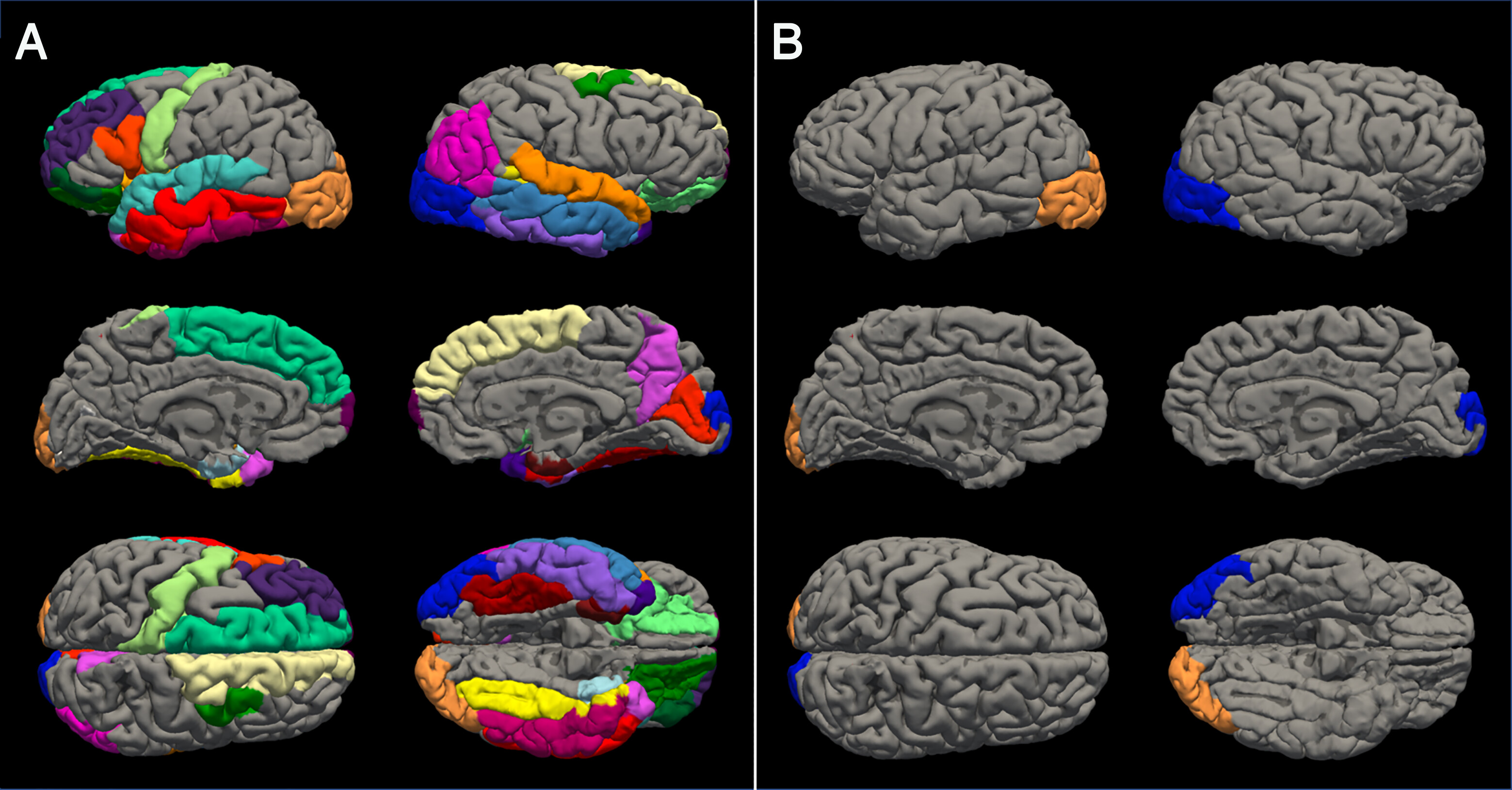 The photo shows two sets of brain scans. On the left are six views of female brains with different coloured regions, while the six brains on the right show boys' brains. The colour distribution across the female brains covers more of each angle, whereas the male brains only have two coloured spots at the back. The photo shows two sets of brain scans. On the left are six views of female brains with different coloured regions, while the six brains on the right show boys' brains. The colour distribution across the female brains covers more of each angle, whereas the male brains only have two coloured spots at the back.