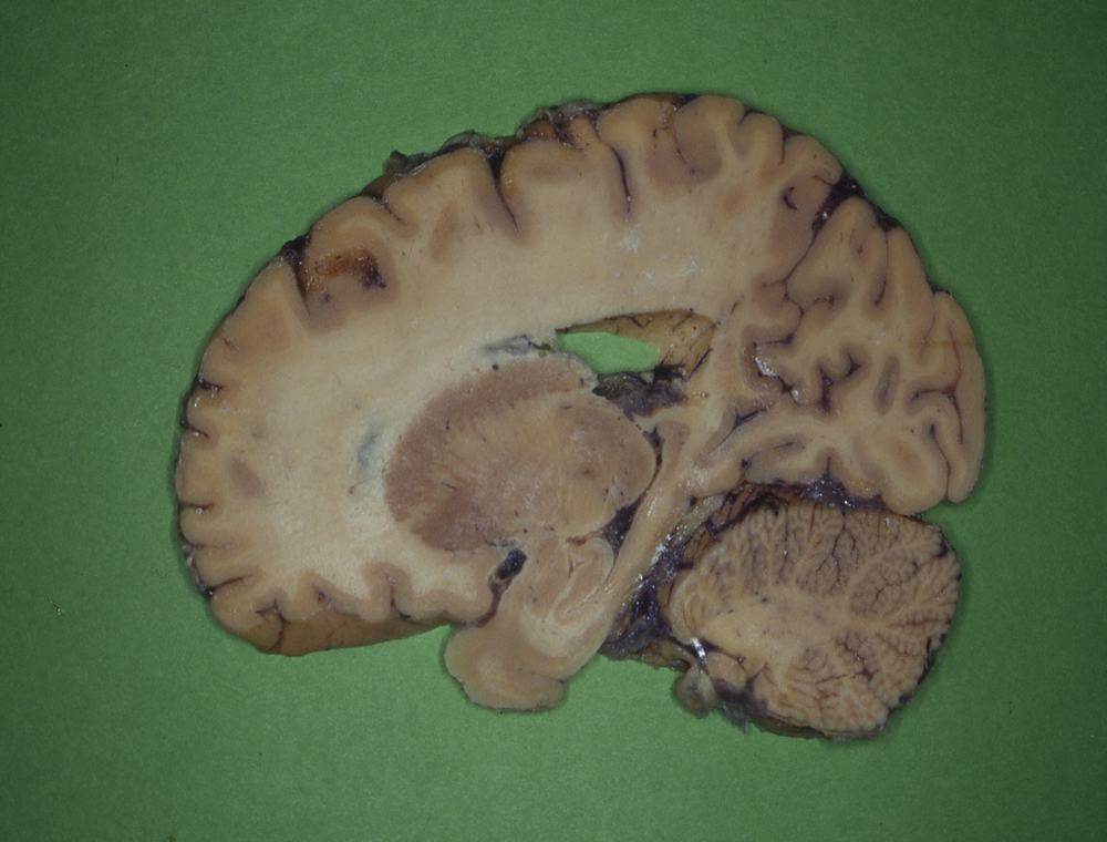 human brain slice human brain slice