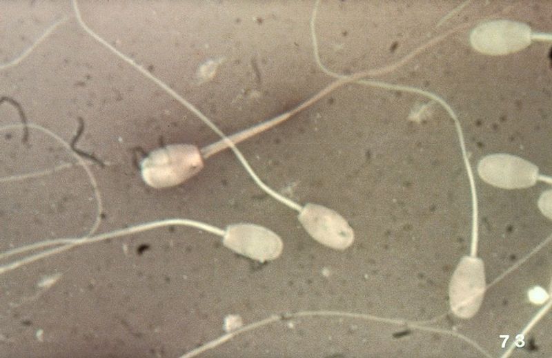 Sperm cells under a microscope, black and white