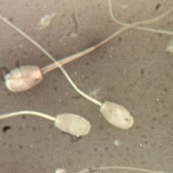 Sperm cells under a microscope, black and white