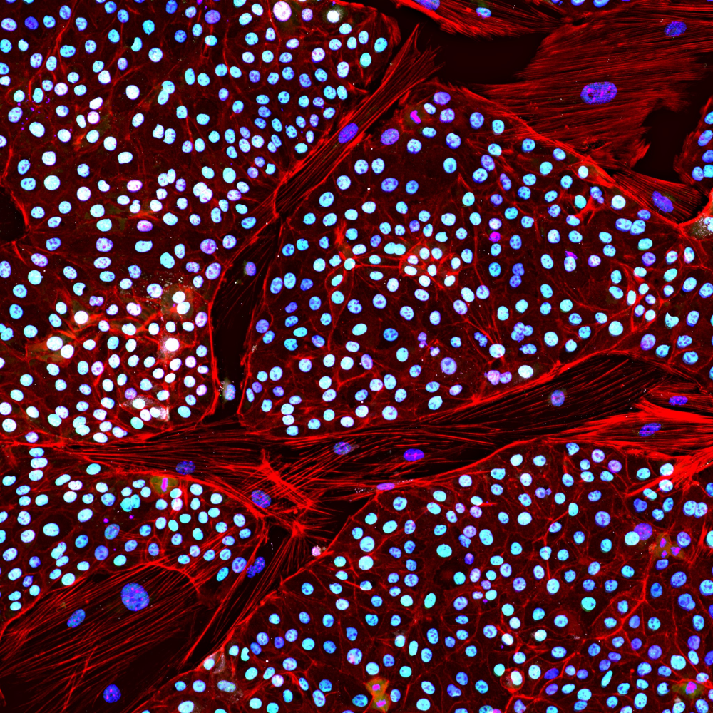 elephant induced pluripotent stem cell elephant induced pluripotent stem cell