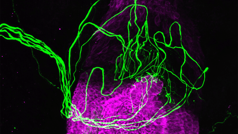A hair follicle, highlighted in purple, surrounded by sensory nerves in green.