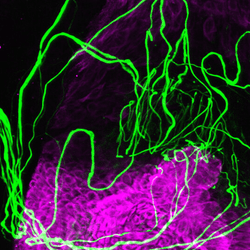 A hair follicle, highlighted in purple, surrounded by sensory nerves in green.