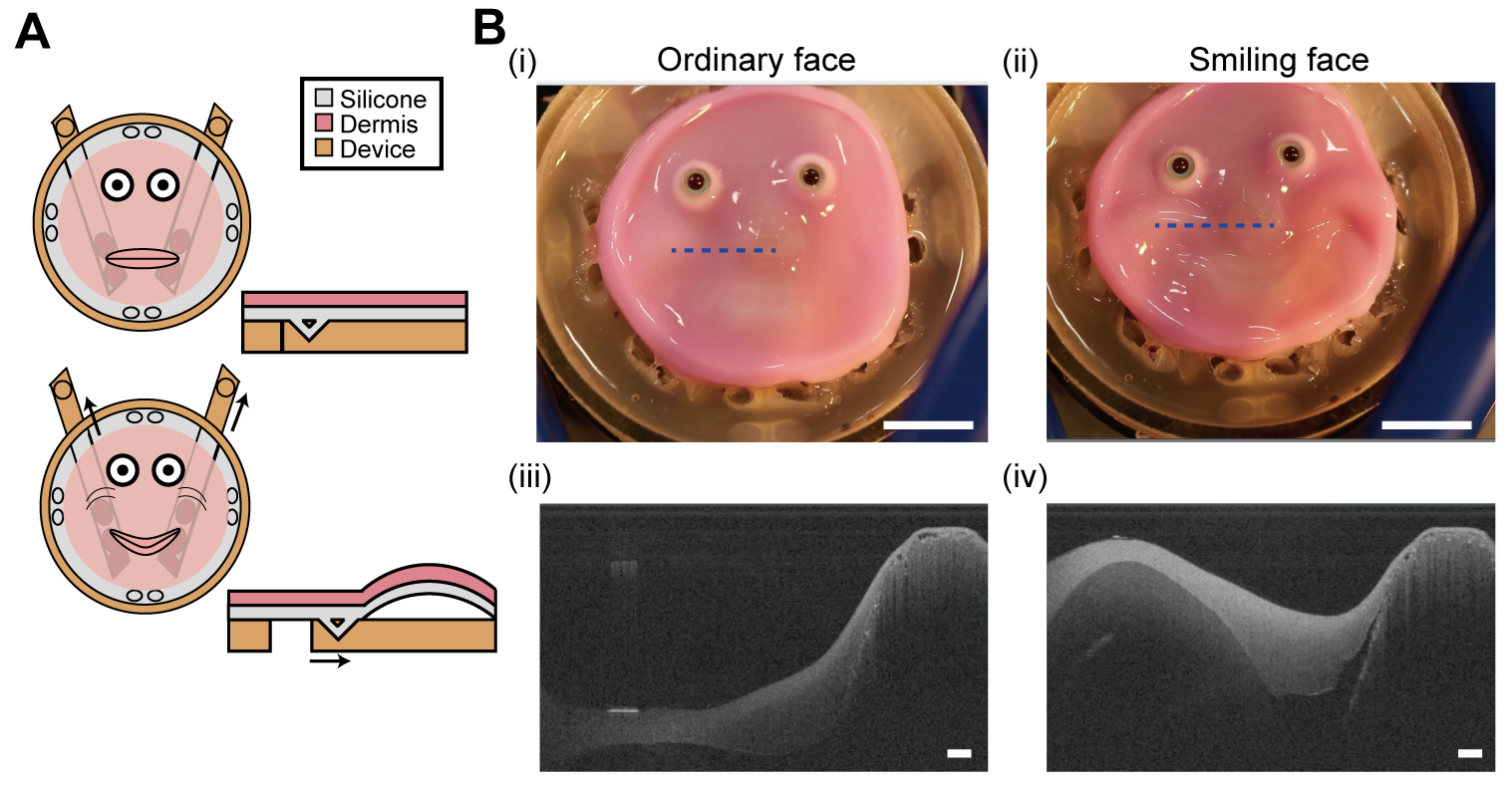 diagrams showing an illustration of the 2D face smiling, a photo of the face smiling, and a black and white cross-section of the tissue changing shape. diagrams showing an illustration of the 2D face smiling, a photo of the face smiling, and a black and white cross-section of the tissue changing shape.