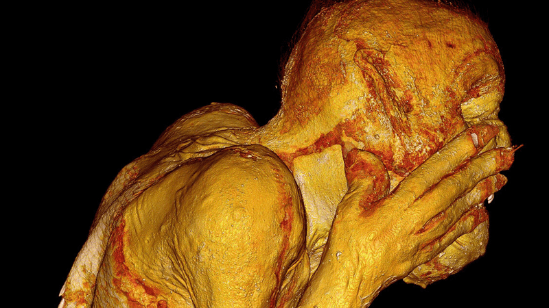 A scan of the "mermaid mummy" showing its head and shoulders.