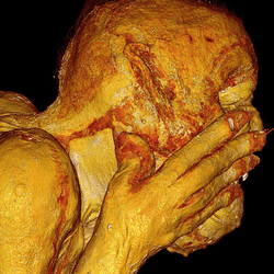 A scan of the "mermaid mummy" showing its head and shoulders.