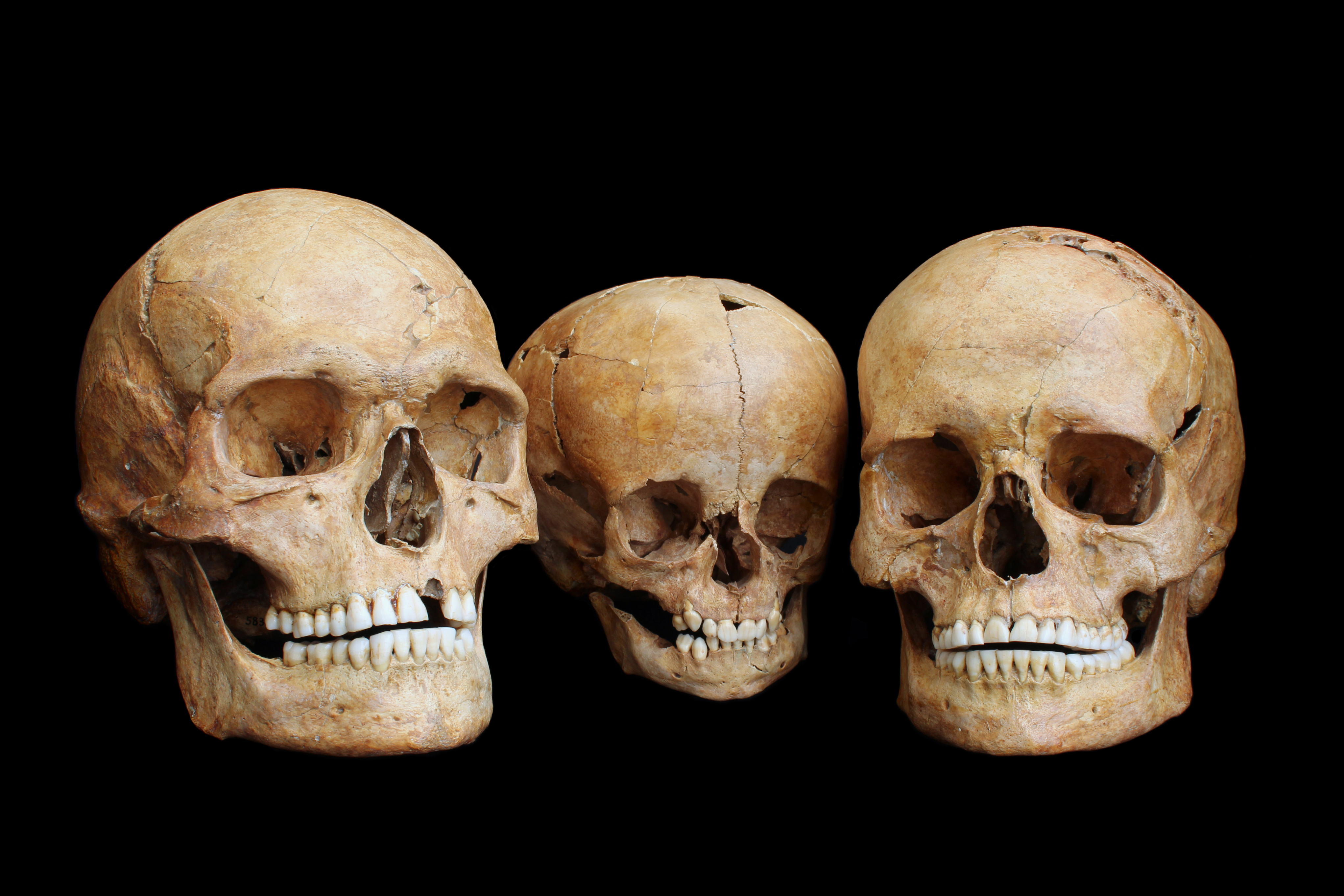 Three ice age skulls from Hohlenstein-Stadel cave. The man (left), a woman (right), and a child (middle) lived around 8,500 years ago when temperatures were not far of today's and the humans whose ancestors survived the worst of the cold were recolonizing remaining parts of the continent. Three ice age skulls from Hohlenstein-Stadel cave. The man (left), a woman (right), and a child (middle) lived around 8,500 years ago when temperatures were not far of today's and the humans whose ancestors survived the worst of the cold were recolonizing remaining parts of the continent.